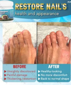 FLYCARE™ 5X QUICK-HEALING Nail Fungus Ointment