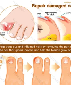 FLYCARE™ Bee Venom Nail Fungus Spray