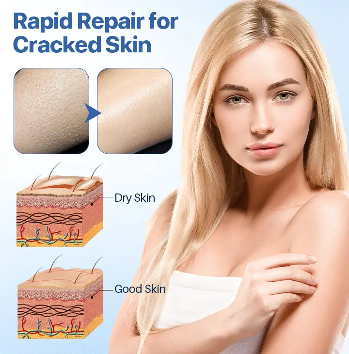 FLYCARE™ FrostCure Winter Cracked Skin Healing Cream