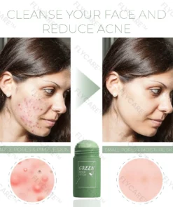 FLYCARE™ Grüntee-Ton-Stick-Maske