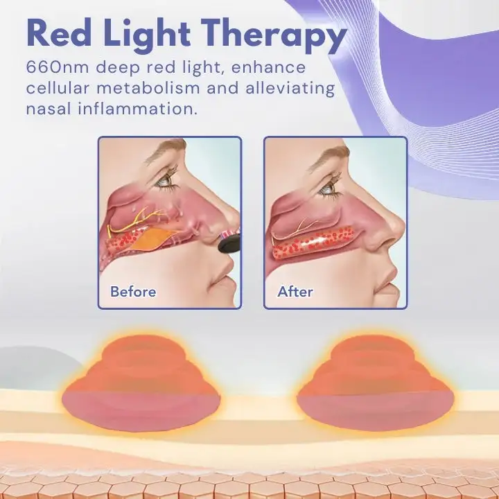 FLYCARE™ RespiEase Nasen-Lichttherapiegerät