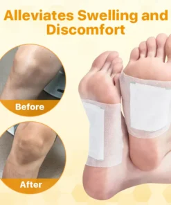 Fivfivgo™ BeeEase Gelenk-Therapie-Pflaster