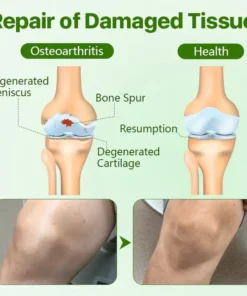 Fivfivgo™ EaseMotion Gelenkpflegeriegel