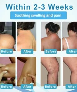 Fivfivgo™ LumpsClear Lymphstütze Roll-On