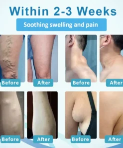 Fivfivgo™ LumpsClear Lymphstütze Roll-On