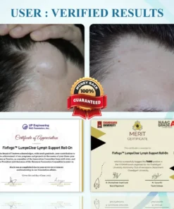 Fivfivgo™ LumpsClear Lymphstütze Roll-On