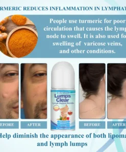 Fivfivgo™ LumpsClear Lymphstütze Roll-On