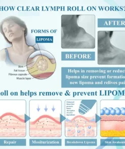 Fivfivgo™ LumpsClear Lymphstütze Roll-On