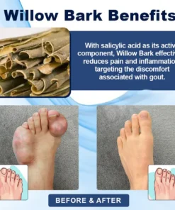 Fivfivgo™ Pflanzliches Gelenkpflaster zur Linderung von Gicht