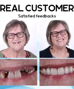 Fivfivgo™ Smart Fit Silikon Reline Prothesenset