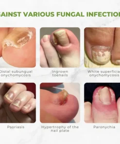 Flycare™ FungiVanish Bee Venom Nail Treatment Oil