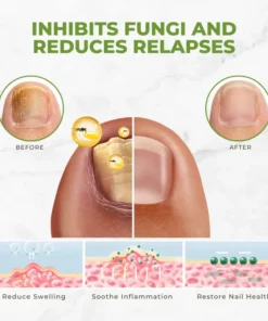 Flycare™ FungiVanish Bee Venom Nail Treatment Oil