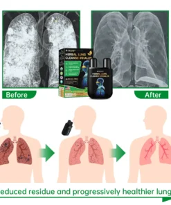 Furzero™ Lung Mucus Cleansing Inhaler