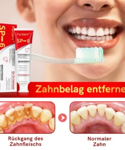 Furzero™ SP-6 Probiotic Ultra Whitening Zahnpasta