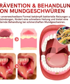 Furzero™ SP-6 Probiotic Ultra Whitening Zahnpasta