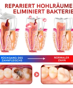 Furzero™ SP-6 Probiotic Ultra Whitening Zahnpasta