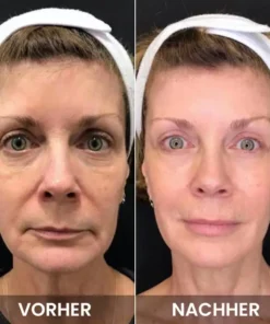 LIMETOW™ Anti-Falten-Augencreme