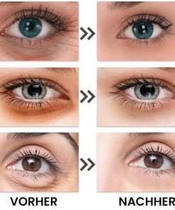 LIMETOW™ Anti-Falten-Augencreme