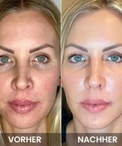 LIMETOW™ Anti-Falten-Augencreme