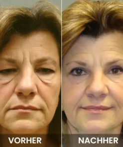 LIMETOW™ Anti-Falten-Augencreme