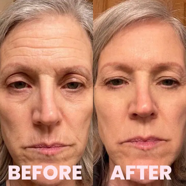 LIMETOW™ Bio-Collagen Real Deep Mask