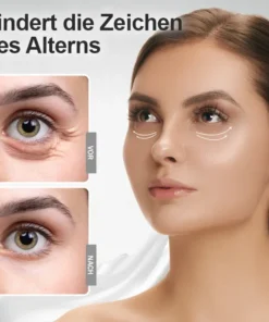 LIMETOW™ Under Eye Puffiness Remover