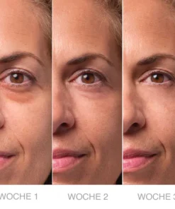 LIMETOW™ Under Eye Puffiness Remover