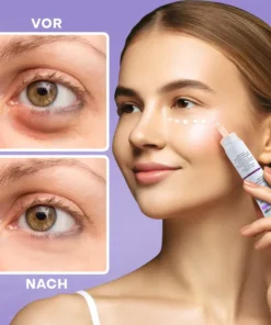 LIMETOW™ Under Eye Puffiness Remover