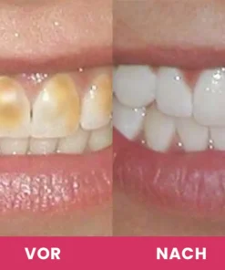 LIMETOW™ Zahnaufhellungs-Essenz-Set