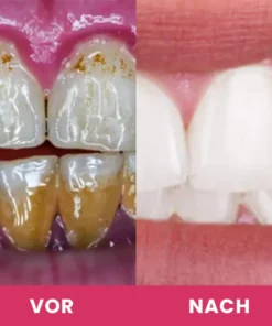 LIMETOW™ Zahnaufhellungs-Essenz-Set