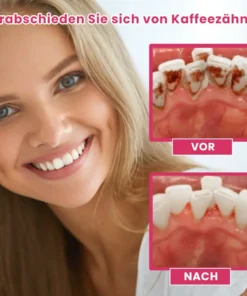 LIMETOW™ Zahnaufhellungs-Essenz-Set