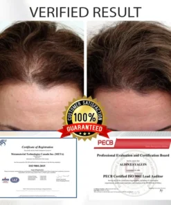 LOVILDS™ Alopecia Recovery Haar-Booster Roll-On