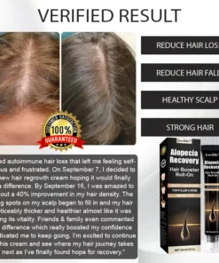 LOVILDS™ Alopecia Recovery Haar-Booster Roll-On