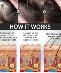 LOVILDS™ Alopecia Recovery Haar-Booster Roll-On