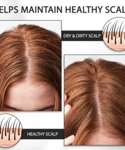 LOVILDS™ Alopecia Recovery Haar-Booster Roll-On