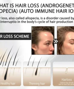 LOVILDS™ Alopecia Recovery Haar-Booster Roll-On