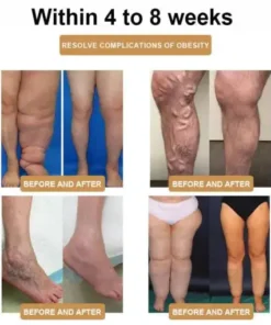 LOVILDS™ Ultrasonic Fat Blasting and Detoxing Wristband