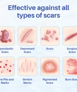 LOVILDS™Silicone Anti-Scar Cream