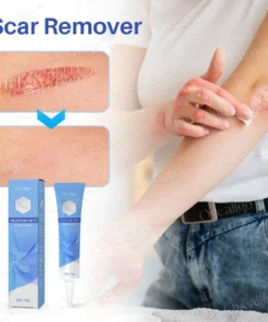 LOVILDS™Silicone Anti-Scar Cream