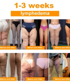 LymphoEase™ Bienengift-Fußbadperlen zur schlankmachenden Lymphentgiftung