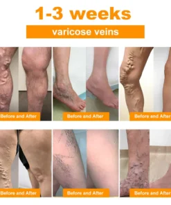 LymphoEase™ Bienengift-Fußbadperlen zur schlankmachenden Lymphentgiftung