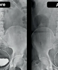 Miniyou™ TitaniumMag Prostata-Wellness-Armband