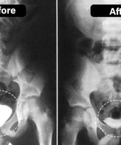 Miniyou™ TitaniumMag Prostata-Wellness-Armband