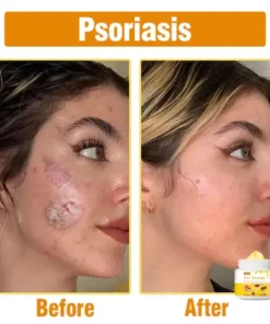 Oveallgo™ Bee Venom Comprehensive Cream