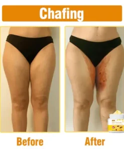 Oveallgo™ Bee Venom Comprehensive Cream