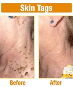 Oveallgo™ Bee Venom Comprehensive Cream