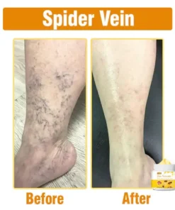 Oveallgo™ Bee Venom Comprehensive Cream