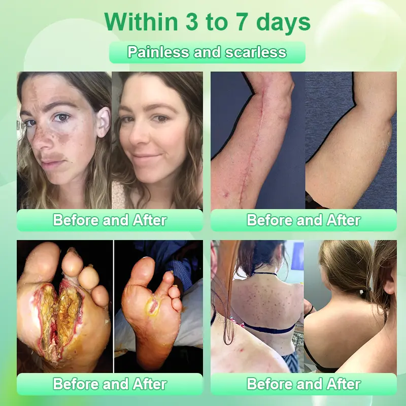 Reinigendes Peeling-Gel für Acanthosis Nigricans