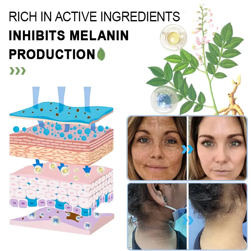 Reinigendes Peeling-Gel für Acanthosis Nigricans