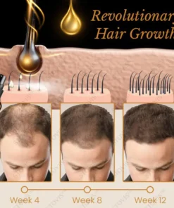 STOVIS™ Biotin Premium Hair Growth Essence Spray